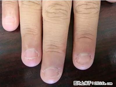 剪指甲、挖耳屎，这些日常小动作竟隐藏大危害！ - 吉林生活资讯 - 吉林28生活网 jl.28life.net